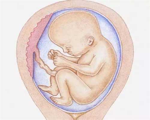 36岁女子卵巢早衰针灸后自然代孕_代孕宝宝健康